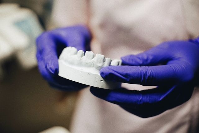 Veneers