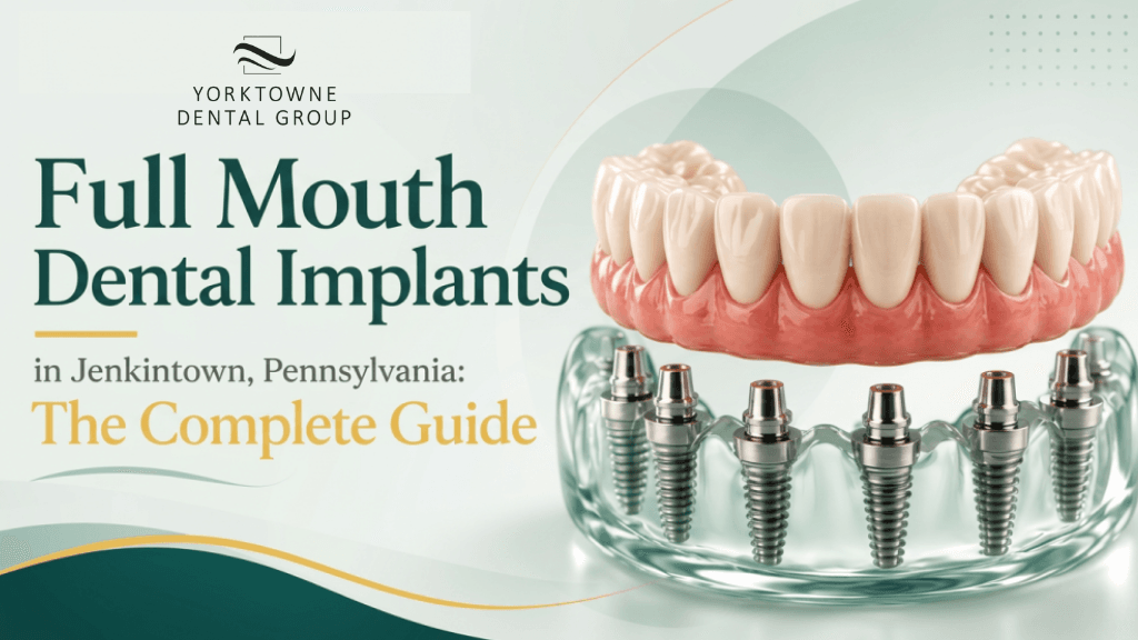 Full Mouth Dental Implants in Jenkintown, Pennsylvania: The Complete Guide