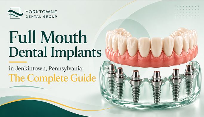 Full Mouth Dental Implants in Jenkintown, Pennsylvania: The Complete Guide