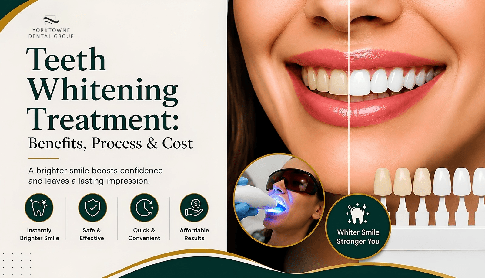 Teeth Whitening Treatment: Benefits, Process & Cost