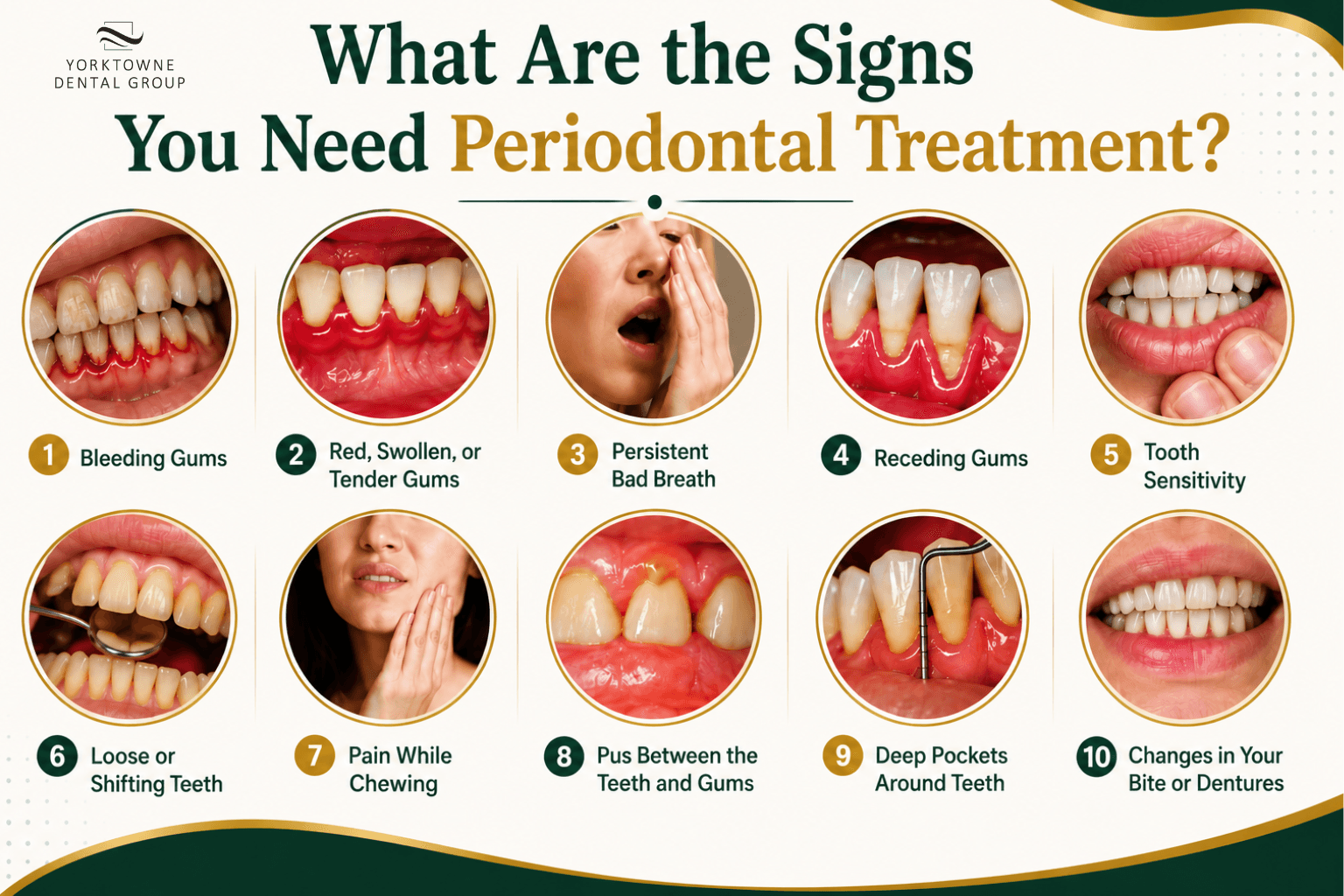 What Are the Signs You Need Periodontal Treatment.png What Are the Signs You Need Periodontal Treatment.png