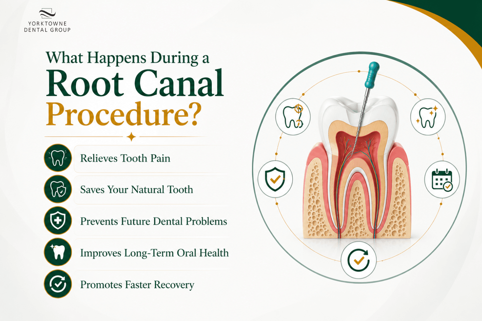 What Happens During a Root Canal Procedure.png What Happens During a Root Canal Procedure.png