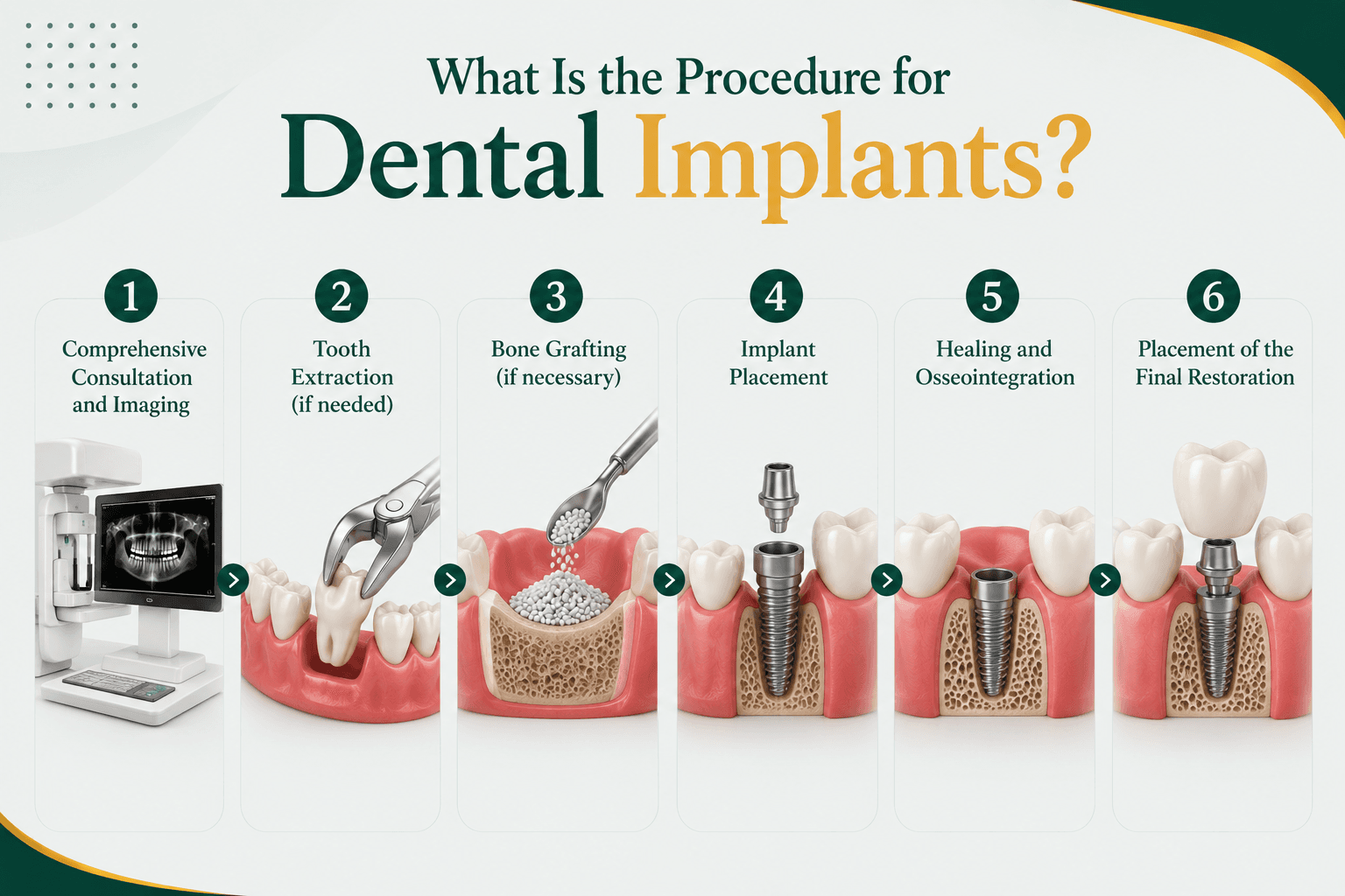 What Is the Procedure for Dental Implants