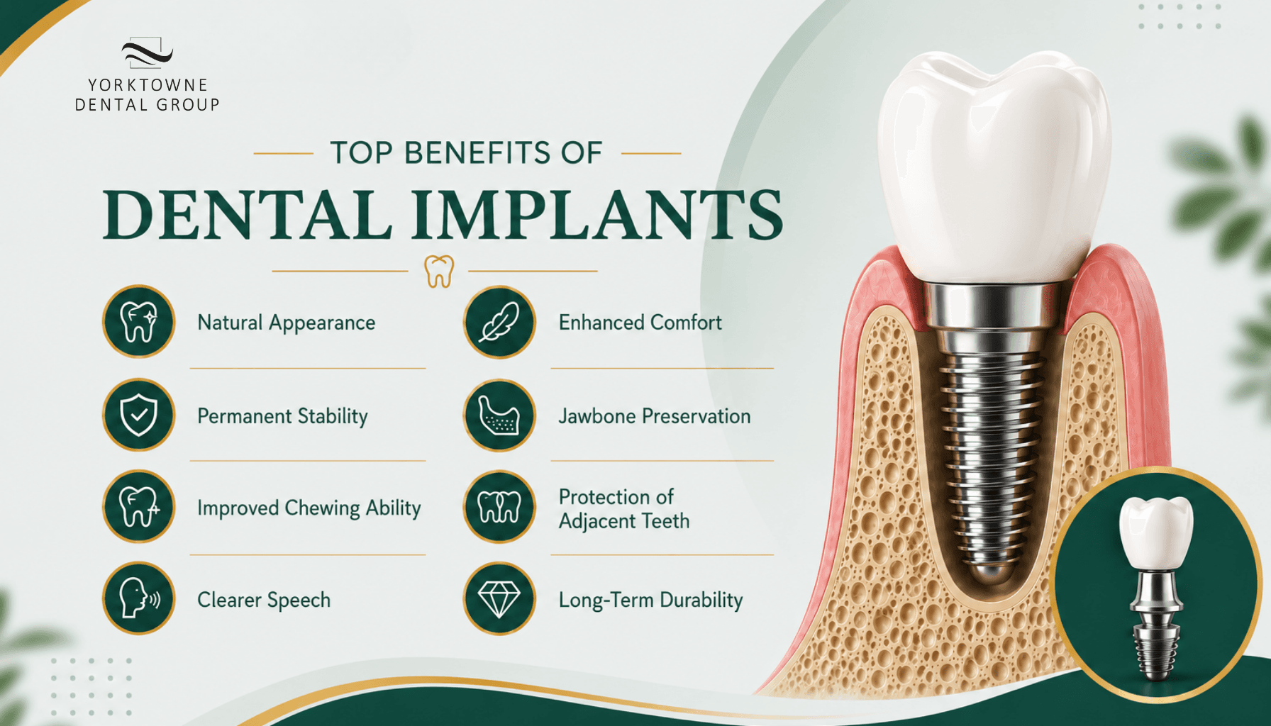 benifits of dental implant.png benifits of dental implant.png