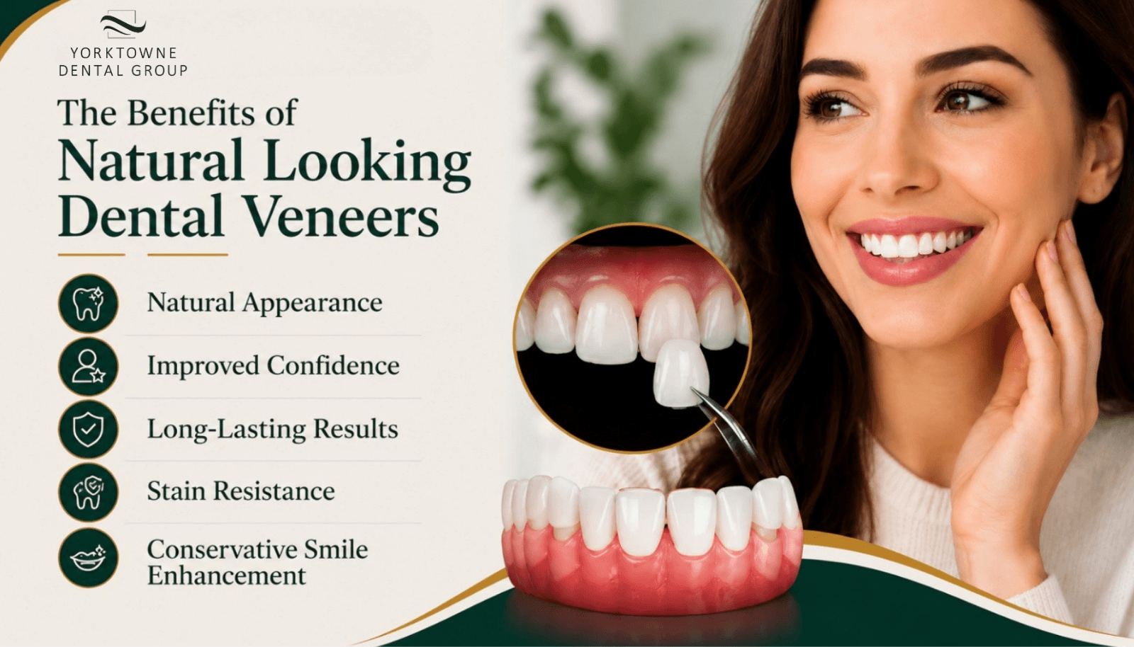 benifits of natural looking veeners.png benifits of natural looking veeners.png
