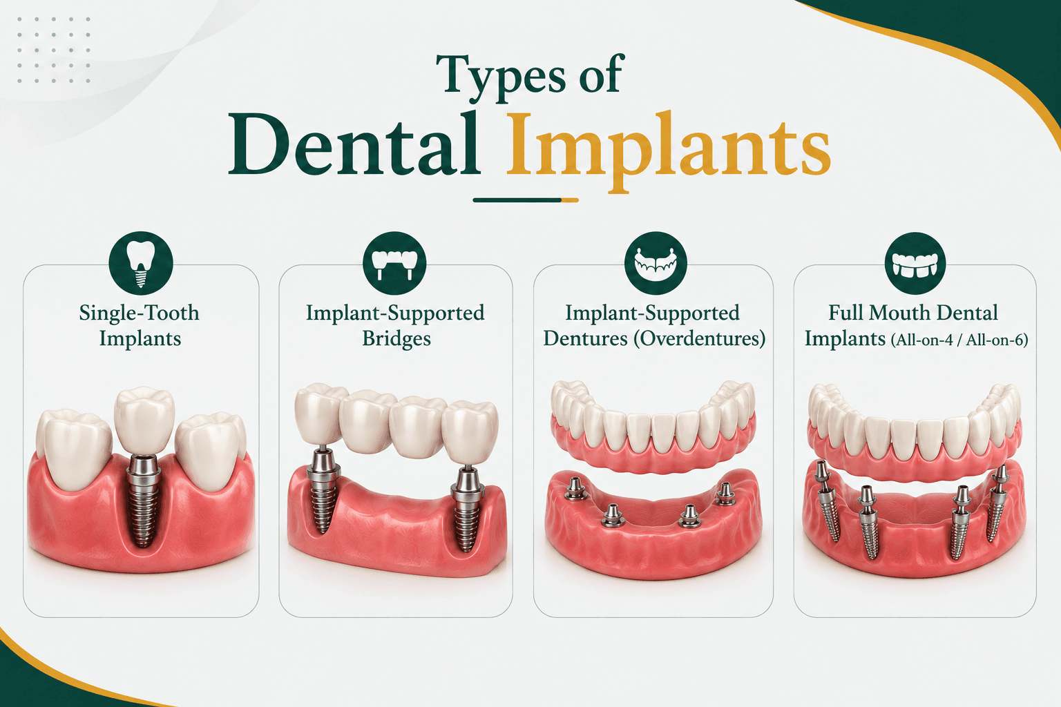 types of dental implant