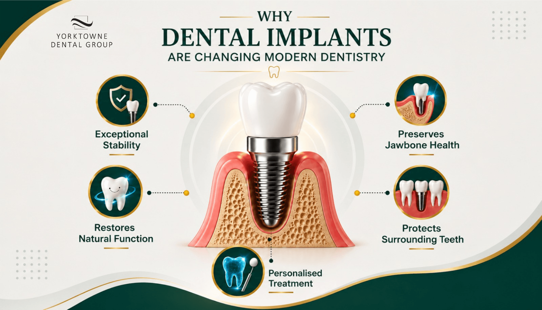 why dental implant.png why dental implant.png